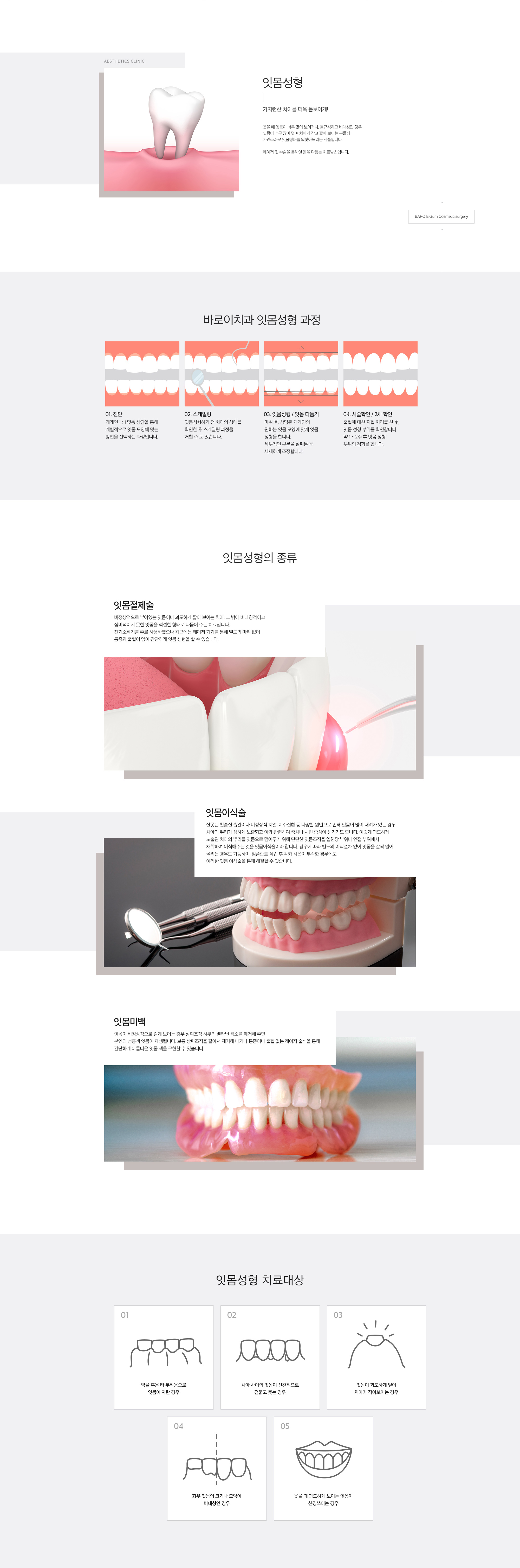 잇몸성형.jpg