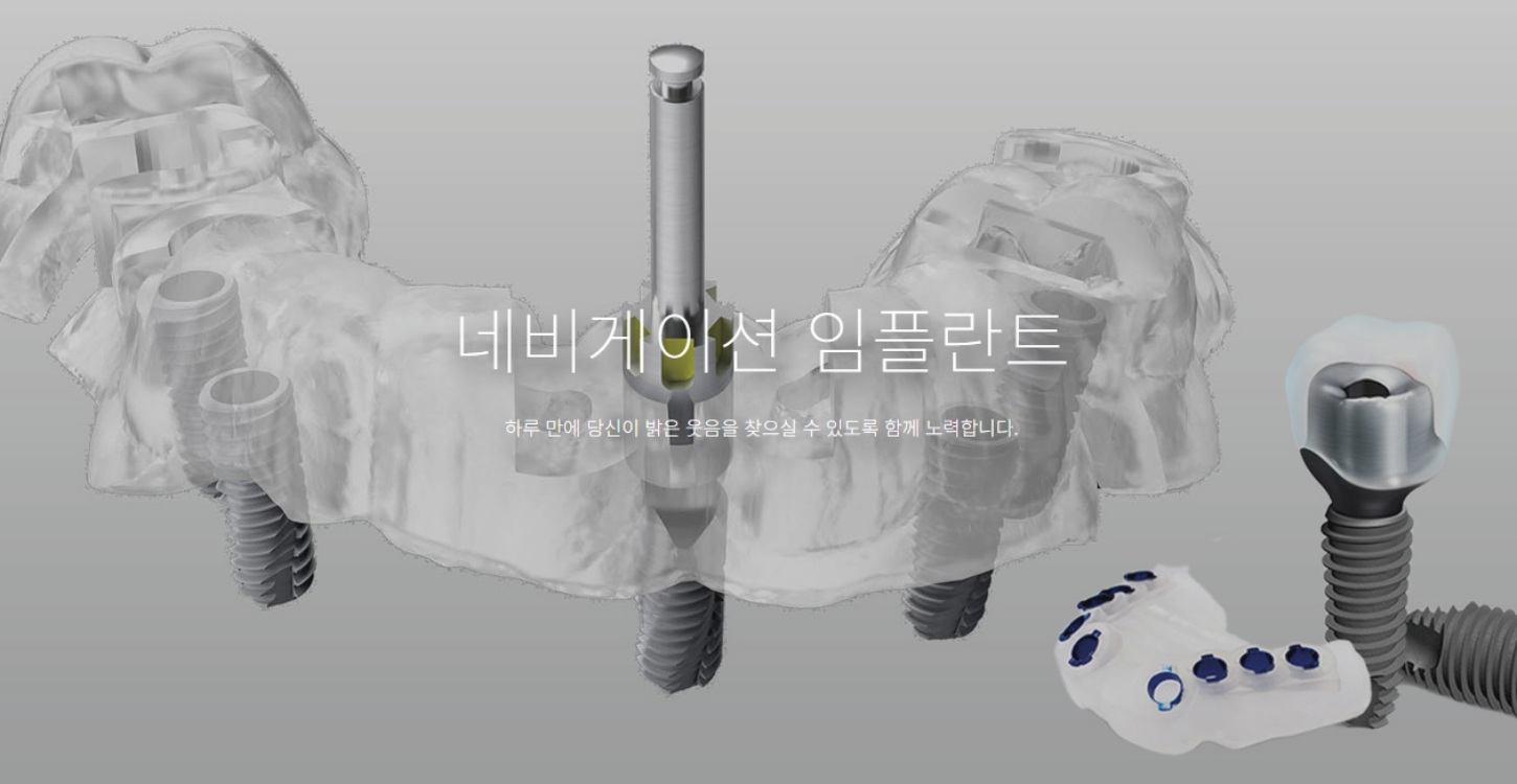 네이게이션임플란트.png